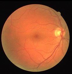 Fundus image